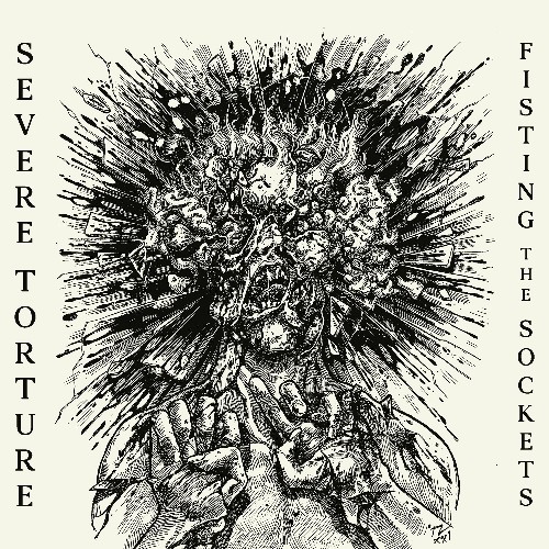 Severe Torture – Fisting The Sockets